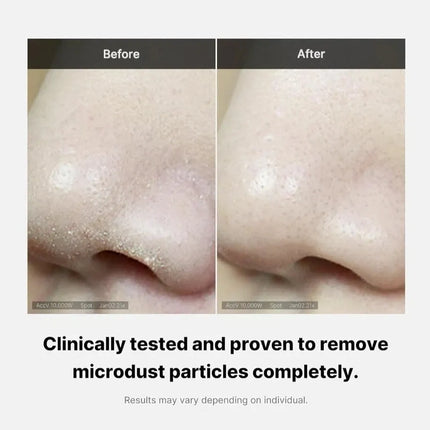 MEDICUBE Zero Foam Cleanser 120g – Deep Cleansing, Pore Care – AU Seller